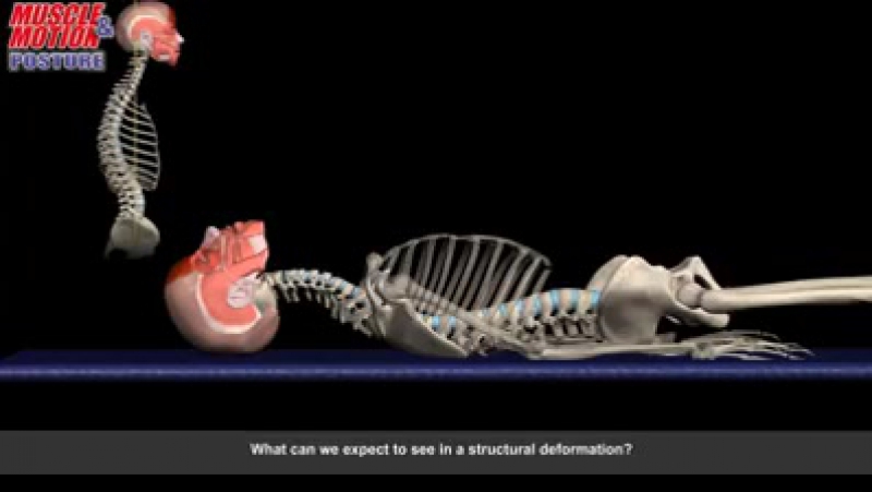 Observing posture patterns while lying on the