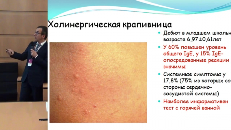 Крапивница ангиоотек диагностика и